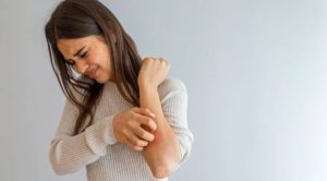 serboični dermatitis 2